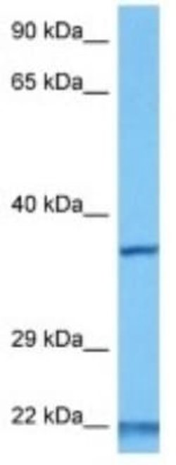 IMP4 Rabbit anti-Human, Polyclonal, Novus Biologicals 100 &mu;g | Buy Online | Novus Biologicals | Fisher Scientific